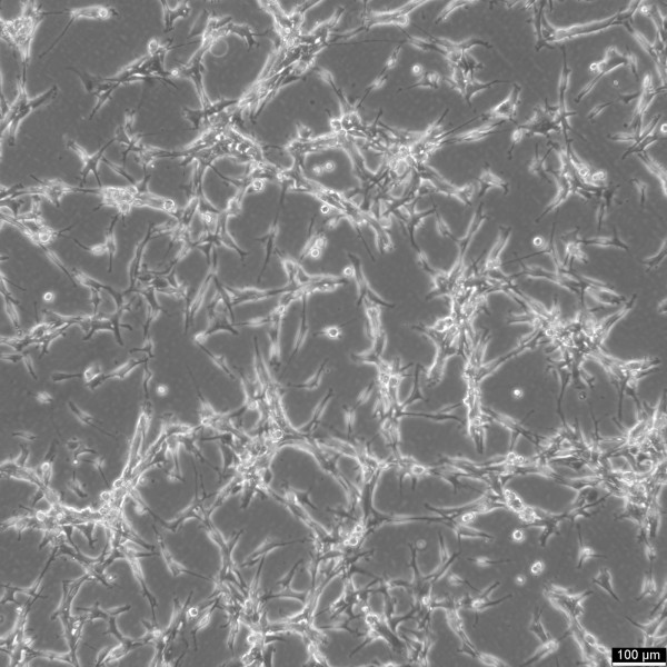 U87MG Cells