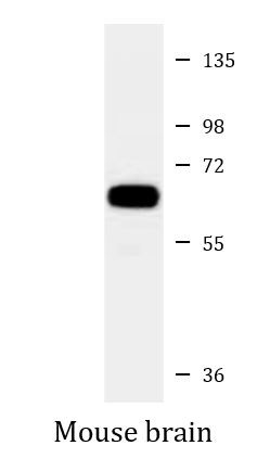 Anti-USP14, clone 889CT6.2.1