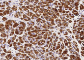 Anti-CLPS/Colipase Monoclonal Recombinant Antibody