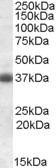 Anti-Clusterin / ApoJ, C-terminal