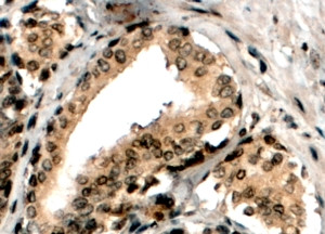 Anti-ERG, C-terminal