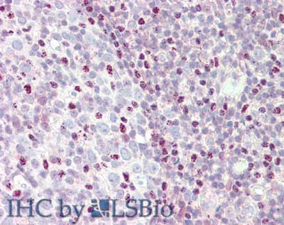 Anti-CTCF