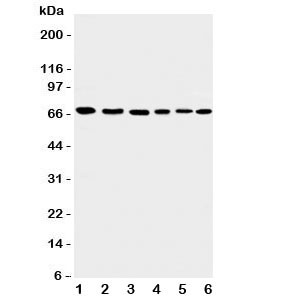 Anti-Apoptosis-Inducing Factor (Mitochondrial marker)