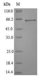 Nucleoprotein (N), Lassa virus, recombinant