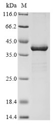 Probable L,D-transpeptidase YbiS (ybiS), Escherichia coli O6:H1, recombinant