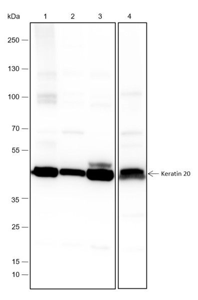 Anti-Recombinant Keratin 20, clone A276
