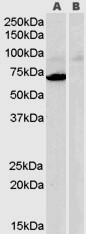 Anti-Monoamine Oxidase A, Internal
