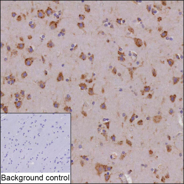 Anti-CDC42BPB
