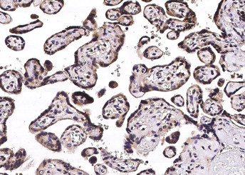 Anti-STUB1 Monoclonal Recombinant Antibody