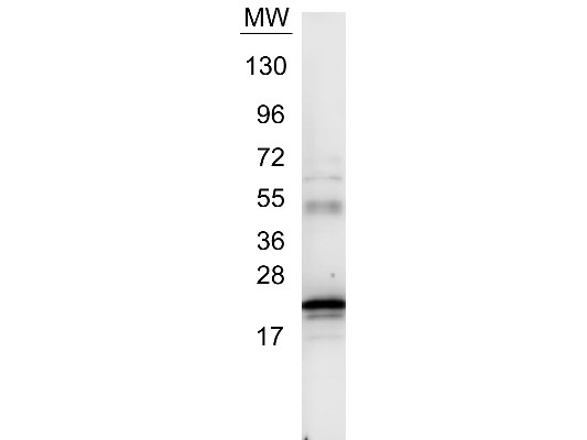 Anti-Interleukin-6 (IL-6) (human)