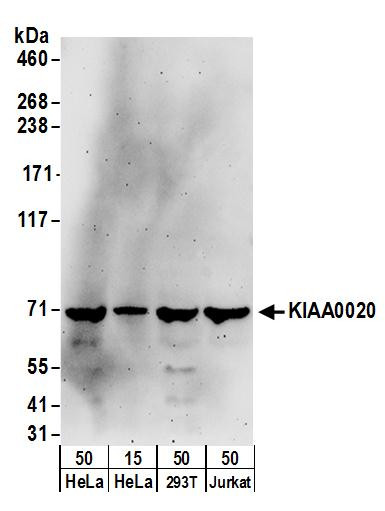 Anti-KIAA0020