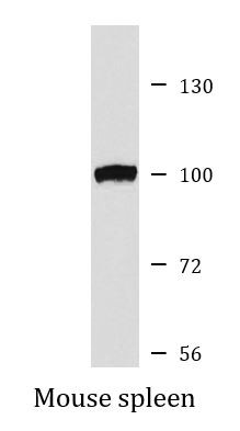 Anti-USP16 / UBP-M