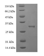 Hematological and neurological expressed 1 protein (HN1), human, recombinant