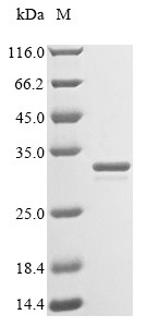 Sortase A (srtA), partial, Staphylococcus aureus, recombinant