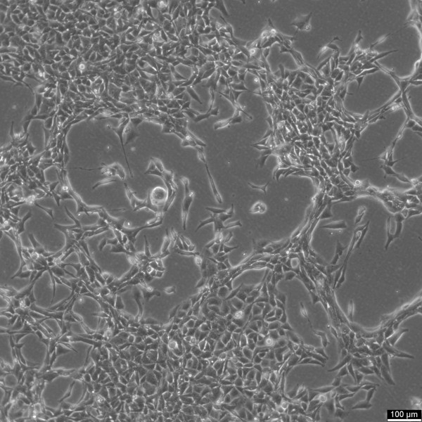NCI-H446 Cells