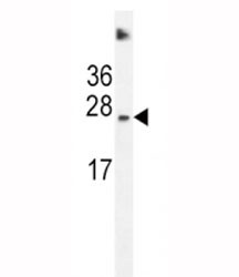 Anti-SDHD