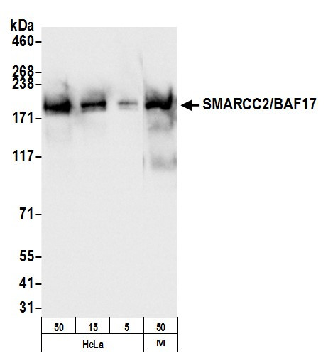 Anti-SMARCC2/BAF170