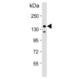 Anti-IRS2 / Insulin receptor substrate 2
