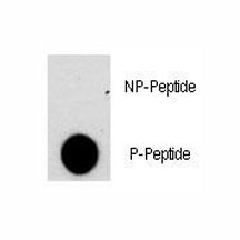 Anti-phospho-NFATC2 (Ser330)