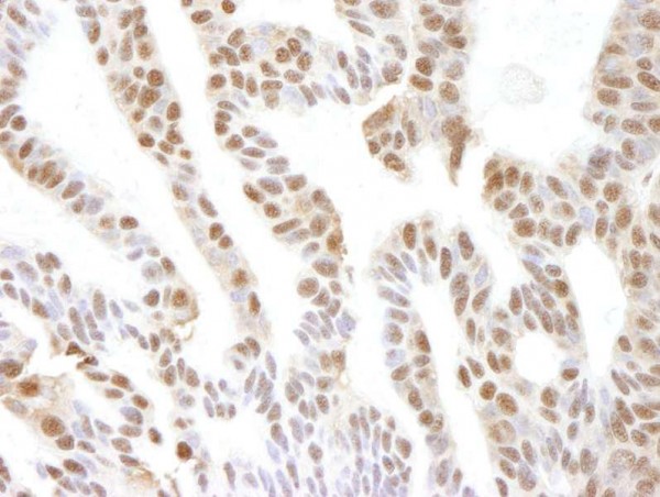 Anti-VCP (IHC)