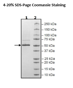 Nucleocapsid Protein (alpha B.1.1.7 Variant), Avi-His-Tag (SARS-CoV-2)