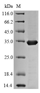Diacylglycerol acyltransferase/mycolyltransferase Ag85C (fbpC), Mycobacterium tuberculosis, recombin