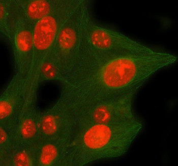 Anti-CDCA8 / Cell division cycle-associated protein 8 / Borealin
