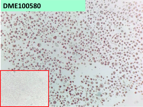 Anti-Her3 antibody(55A1), Rabbit mAb