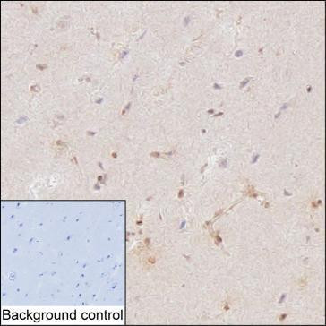Anti-HDAC9