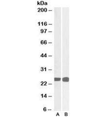 Anti-GRB2