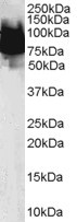 Anti-KLF4, N-terminal