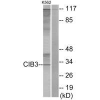 Anti-CIB3