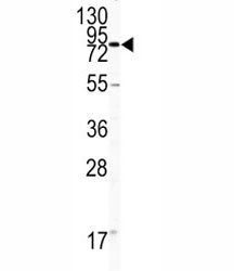 Anti-CD31