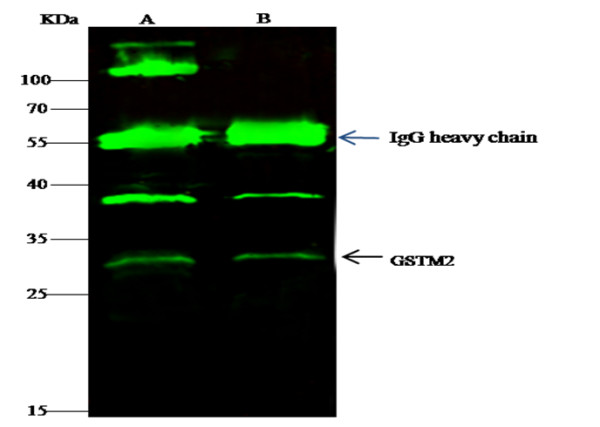 Anti-GSTM2 Monoclonal Recombinant Antibody