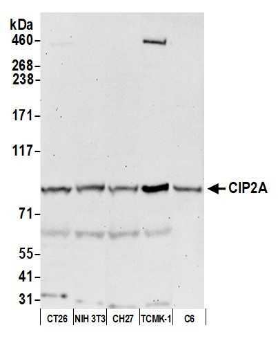 Anti-CIP2A