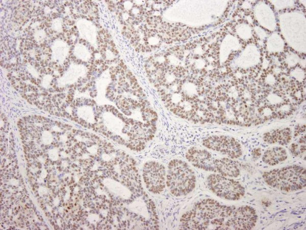 Anti-MDC1 (IHC)
