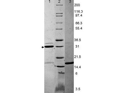 Interleukin-17A (IL-17A), human recombinant (rHuIL-17A)