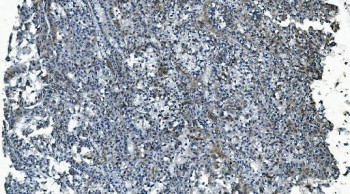 Anti-MCU / Calcium uniporter protein, mitochondrial