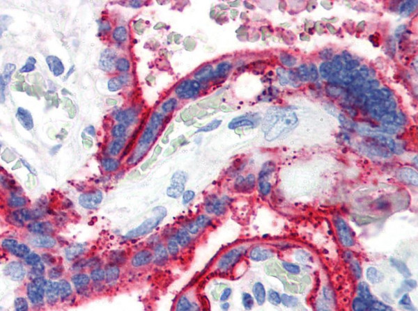 Anti-CD59, clone MEM-43