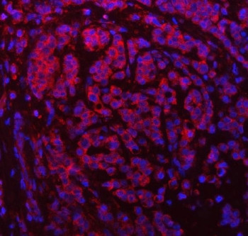 Anti-SDF2L1 / SDF2-like protein 1