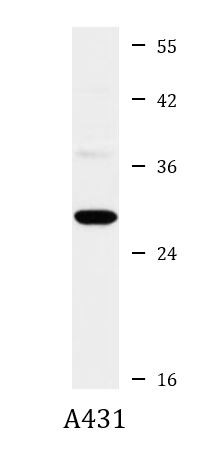 Anti-PDCD10