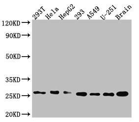 Anti-ID1 Recombinant Monoclonal, clone 2C7
