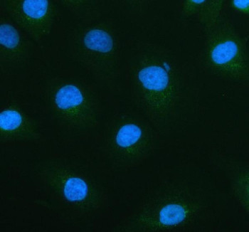 Anti-ACOX1 / Peroxisomal acyl-coenzyme A oxidase 1