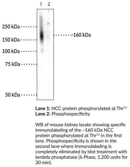 Anti-NCC (Phospho-Thr53)