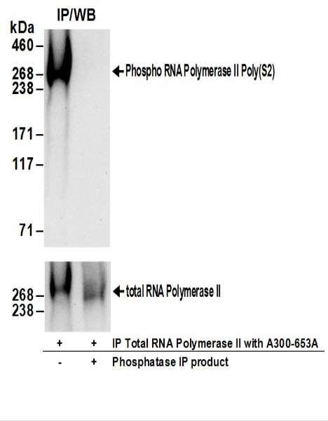 Anti-RNA Polymerase II, Phospho (S2)