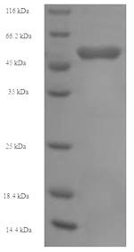 Succinyl-CoA:3-ketoacid-coenzyme A transferase 1, mitochondrial (OXCT1), human, recombinant