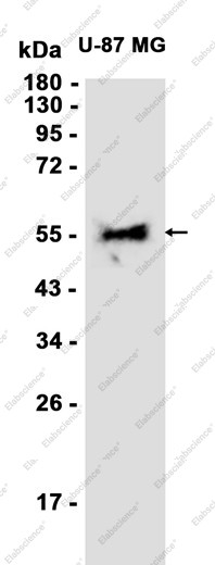 Anti-Recombinant Retinoic Acid Receptor beta, clone C313089