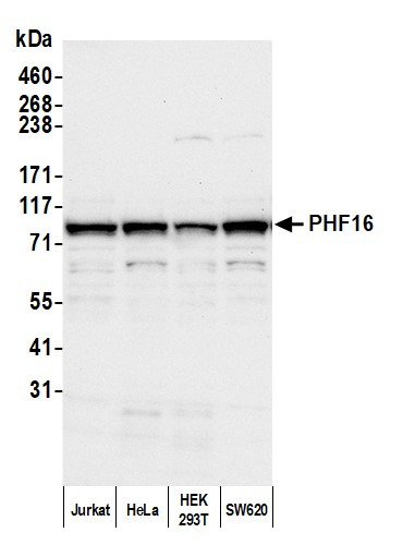 Anti-PHF16