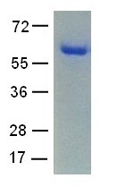 Fascin1 (Fascin homolog 1, actin-bundling protein, FSCN1, SNL, p55), human, recombinant full length,