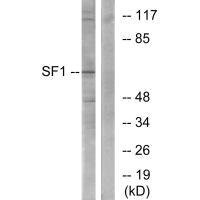 Anti-SF1 (Ab-82)